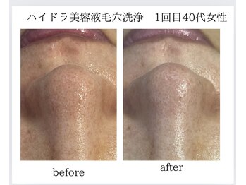 ナイングラム(ninegram)/