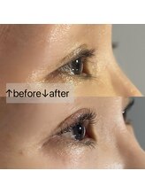 バタフライジュエル 問屋町店(ButterflyJewel)/根元から立ち上げ