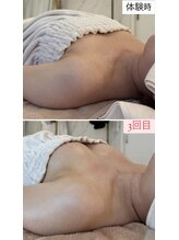 ラビス(RAVIS)/３0代☆3ヶ月後D→Eカップへ！