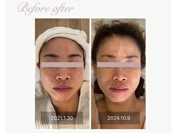 パルタージュ(Partage)/オーダーメイドプログラム★