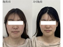 ヴェルシック(Belchic)/劇的変化を実感いただいています