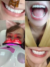 エクシア ニイガタ(ecxia niigata)/新潟人気No.1ホワイトニング