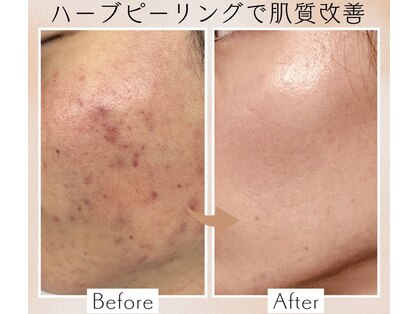 バーグトータルビューティー(bague total beauty)の写真