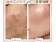 バーグトータルビューティー(bague total beauty)の写真