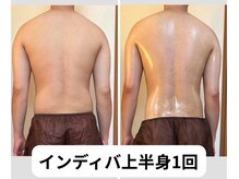 ランネル(Runnel)/インディバビフォーアフター