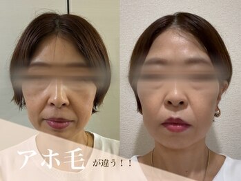 いやしの家さくら/浮いた毛の違い