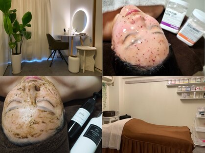 ルビー(Ruby)の写真