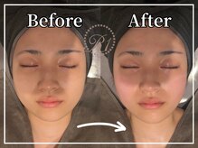 R-1ビューティーサロン 銀座/Before＆After