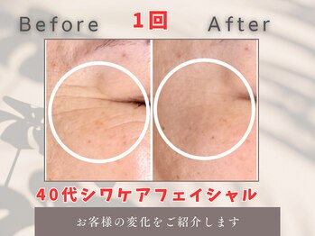 トータルビューティー雅/水素イオンコース