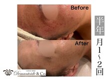 デマントイド 倉敷(Demantoide&Co)/メンズフェイシャル