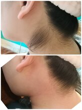 エン(en.)/BeforeAfter写真27