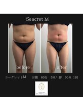 ベルフィーヌボーテ(BELFINE beaute)/シークレットMお腹60分