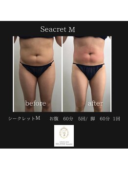 ベルフィーヌボーテ(BELFINE beaute)/シークレットMお腹60分