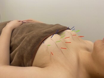 ローカス(LOCUS)の写真/《バストアップ美乳鍼》バストにハリ・弾力を与え、憧れの美乳を実現♪大きさ・左右差・形などのお悩みに◎