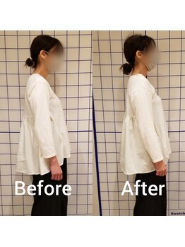 サロンリーベ(salon reve)/40代女性／ねこ背でお悩み