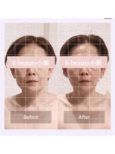 ケービューティー 小顔(K-beauty)/小顔コルギ