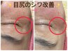 《思いっきり笑える目元へ!!》眼精疲労も取り除きパッチリ素敵な輝く瞳に★