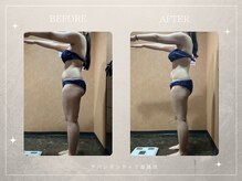 アバンダンティア 姫路店/脂肪冷却