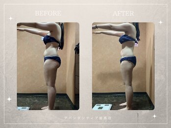 アバンダンティア 姫路店/脂肪冷却