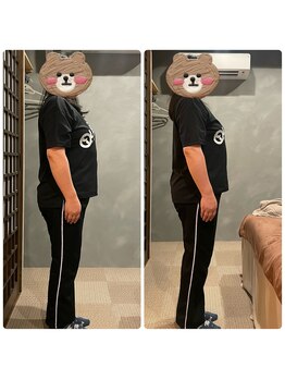 ツーアップ(2up)/たった30分で姿勢改善,厚み解消