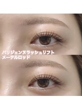 レディエント(Radiant)/パリジェンヌ/メーテルロッド