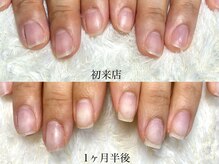 グラシナ 鳥丸店/(深爪/長さだし/フィルイン/)