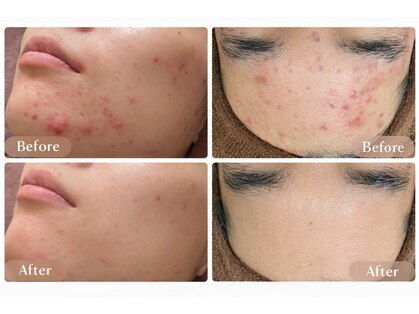 ビオエル 横浜店(Bioel)の写真