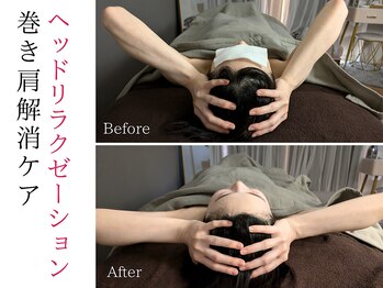 スナリ(SUNARI)/ヘッドスパBefore→After