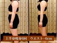 サロン セドナ(SALON SEDONA)/上半身痩身6回 ブライダル痩身　