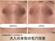 サンゴ(Sango)の写真/夏に気になる毛穴に◎キュッと引き締め、黒ずみ改善！ストレスフリーな自信の持てる素肌へ♪満足度No1★