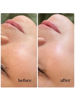 ラシック(Rachic)/細胞復元パック