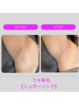 レビア(Revia)/即ツル・スッキリ・ワキ脱毛◎