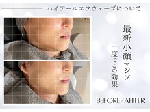 ユアーズ ビューティー(YOURS beauty)/1回で驚きの小顔へ☆