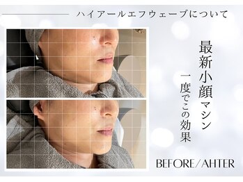 ユアーズ ビューティー(YOURS beauty)/1回で驚きの小顔へ☆