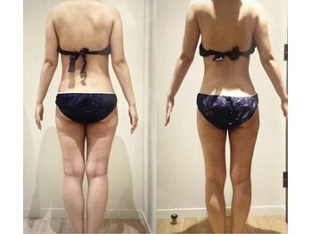 アユアランリンク 札幌店/30代前半/約2ヵ月半/-3.7kg/背面