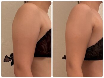 フランベル(Franc bell)/パイラソード【二の腕モニター】