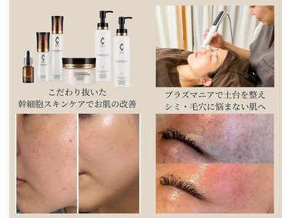 ミュベル(Myubelle)の写真