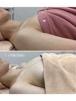 ビューティーサロン シンデレラ 心斎橋本店(Cinderella)の写真/【ドレス映えするふっくらなお胸に♪】結婚式の前撮りにもオススメ◎通う度にしっかり育乳でボリュームUP!!