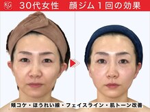 那賀洋子式 顔ジム 大分戸次店