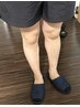 【お得3部位/見た目清潔感UP】顔+腕+脚セット脱毛 ¥8,000
