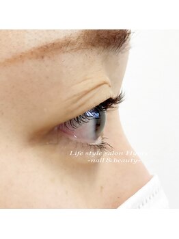 ヒーミー(Hymy)/ラッシュカール