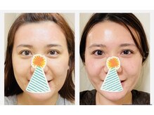 ビースマイル(Be-Smile)の雰囲気（コルギbefore after/少しずつ骨格が上がり#小さくなります。）