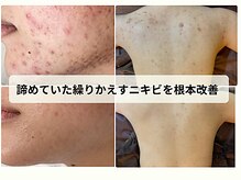 ムーンアンドアース(moon&earth)の雰囲気（なにをしても変わらなかった方/根本改善を目指す方に◎）