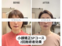 セリア(CELIA)の雰囲気（小顔矯正 /小顔/リンパマッサージ/ドライヘッドスパ/渋谷/表参道）
