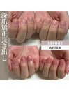 深爪矯正長さ出しワンカラー