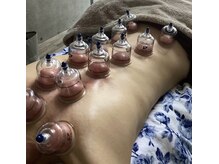 サクランボ(SAKURAMBO)/カッピング、やってみてね！