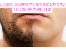 グラムアップ サッポロ(Glam up Sapporo)の雰囲気（メンズも大歓迎！ヒゲ脱毛は2回で効果を実感全身脱毛可能）