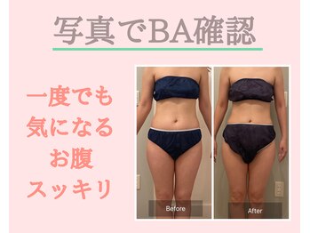 ヨサパーク コクリ(YOSA PARK kokuRi)/痩身/ダイエット/リンパ/産後