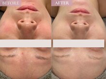 ベベ 表参道(bebe)/お悩み：赤み