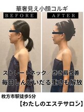 わたしの 大阪枚方本店/ストレートネック/巻き肩改善